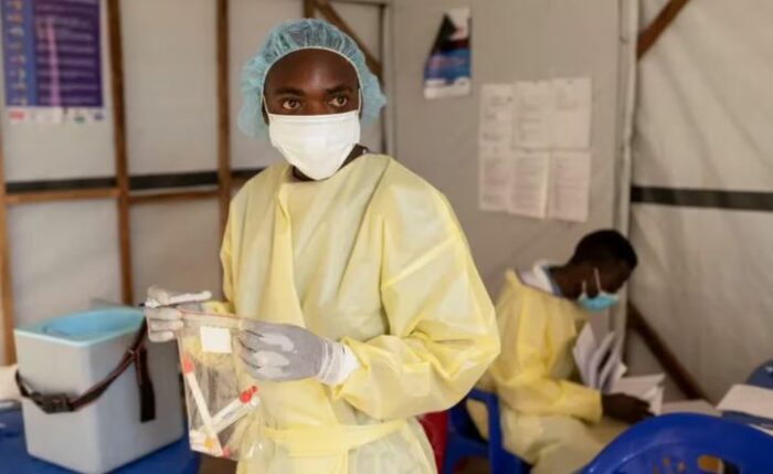 Confirmaron 584 muertes por la viruela del mono en el Congo y la OMS espera más casos en Europa