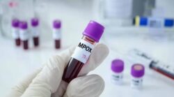 ¿Qué significa que la OMS indicara que la viruela símica no es el nuevo Covid-19?