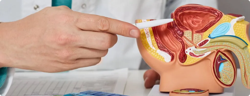 Más de 450 costarricenses mueren anualmente por cáncer de próstata: ¿Qué medidas se pueden tomar?