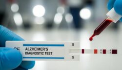 Estados Unidos aprobó un nuevo análisis de sangre para detectar cambios asociados al Alzheimer